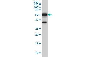 ROD1 monoclonal antibody (M01), clone 4C9 Western Blot analysis of ROD1 expression in Hela S3 NE . (PTBP3 抗体  (AA 16-114))