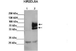 Sample Type: Lane 1: FALG IP'd FLAG-KIR2DL4 transfected NK92 cells Lane 2: FALG IP'd FLAG-KIR2DL5 transfected NK92 cells Primary Antibody Dilution: 1:500Secondary Antibody: Anti-rabbit-HRP Secondary Antibody Dilution: 1:00,000 Color/Signal Descriptions: KIR2DL5A  Gene Name: Kerry S. (KIR2DL5A 抗体  (C-Term))