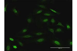 Immunofluorescence of purified MaxPab antibody to DUSP22 on HeLa cell. (DUSP22 抗体  (AA 1-184))