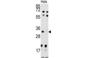 Western Blotting (WB) image for anti-Uridine-Cytidine Kinase 2 (UCK2) antibody (ABIN3003032) (UCK2 抗体)