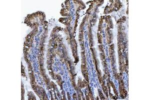 IHC analysis of LI Cadherin/CDH17 using anti-LI Cadherin/CDH17 antibody (ABIN7600855). (LI Cadherin 抗体  (AA 24-695))