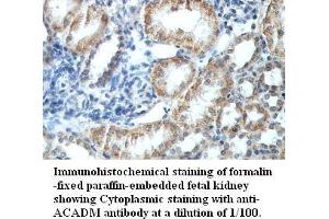 Image no. 1 for anti-Medium-Chain Specific Acyl-CoA Dehydrogenase, Mitochondrial (MCAD) antibody (ABIN791208) (Medium-Chain Specific Acyl-CoA Dehydrogenase, Mitochondrial (MCAD) 抗体)