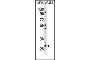 Western blot analysis of PSMG2 Antibody (C-term) in MDA-MB468 cell line lysates (35ug/lane). (PSMG2 抗体  (C-Term))