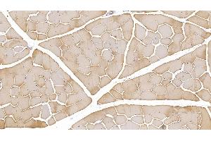 Immunohistochemistry (IHC) image for anti-Actin, Alpha, Cardiac Muscle 1 (ACTC1) (AA 156-368) antibody (ABIN7428392)