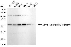 Western blotting analysis using solute carrier family 7 member 11 antibody (ABIN7800400).
