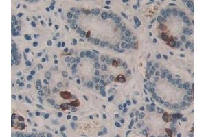 Detection of NEIL1 in Human Stomach Tissue using Polyclonal Antibody to Nei Endonuclease VIII Like Protein 1 (NEIL1)