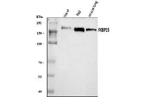 Western blot analysis of FKBP135/FKBP15 using anti-FKBP135/FKBP15 antibody (ABIN7600397). (FKBP15 抗体  (AA 19-1210))