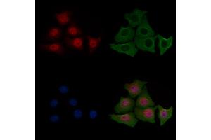 ABIN6255180 and ABIN6267443 staining HepG2 cells(4h of LPS treatment) by IF/ICC. (Cofilin 抗体  (pSer3))
