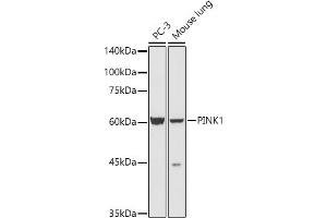 Western blot analysis of extracts of various cell lines, using PINK1 antibody (ABIN6128458, ABIN6145666, ABIN6145668 and ABIN6222945) at 1:500 dilution. (PINK1 抗体  (AA 282-581))