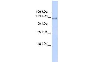 WB Suggested Anti-SUPT16H Antibody Titration:  0. (SUPT16H 抗体  (Middle Region))