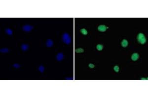 Immunofluorescence analysis of 293T cells using DiMethyl-Histone H3-K36 Polyclonal Antibody (Histone 3 抗体  (2meLys36))