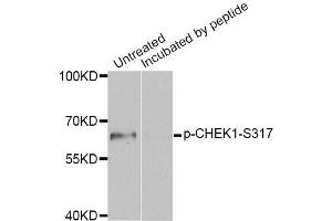 Western blot analysis of extracts of MCF7 cell line, using Phospho-CHEK1-S317 antibody (ABIN5969879). (CHEK1 抗体  (pSer317))