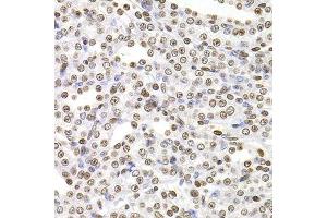 Immunohistochemistry of paraffin-embedded rat kidney using SOX5 antibody. (SOX5 抗体  (AA 1-120))