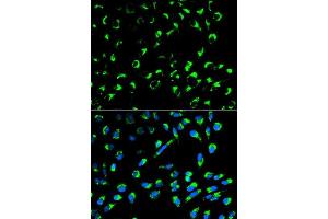 Immunofluorescence analysis of MCF-7 cells using SFN antibody. (14-3-3 sigma/SFN 抗体  (AA 1-248))