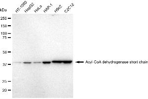 Western blotting analysis using Acyl-CoA dehydrogenase short chain antibody (ABIN7797493). (Recombinant Acyl Co-A Dehydrogenase (AIDB) (chain short) 抗体)