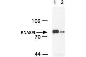 Western blot analysis of RNASEL in insect cell extracts transfected with recombinant human RNASEL using RNASEL monoclonal antibody, clone 2E9 . (RNASEL 抗体)
