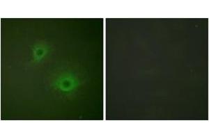Immunofluorescence analysis of HuvEc cells, using EPHB1/2 (Ab-594/604) Antibody. (EPHB1/2 抗体  (AA 561-610))