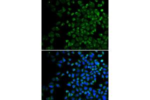 Immunofluorescence analysis of HeLa cells using BAK1 antibody. (BAK1 抗体)