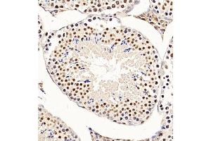 Immunohistochemistry of paraffin embedded mouse testis using CHD1L (ABIN7073491) at dilution of 1:650 (300x lens) (CHD1L 抗体)