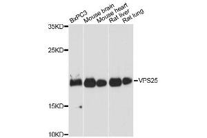 Western blot analysis of extracts of various cell lines, using VPS25 antibody. (VPS25 抗体)