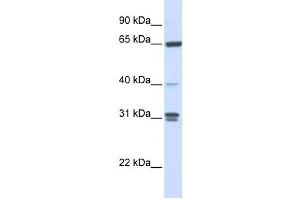 Western Blotting (WB) image for anti-Guanylate Binding Protein 2, Interferon-Inducible (GBP2) antibody (ABIN2459799) (GBP2 抗体)
