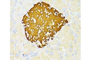 Immunohistochemistry of paraffin-embedded Mouse pancreatic islets using DDIT3 / CHOP Polyclonal Antibody at dilution of 1:100 (40x lens). (DDIT3 抗体)