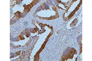 IHC analysis of PYROXD1 using anti-PYROXD1 antibody (ABIN6719650). (PYROXD1 抗体  (AA 48-230))