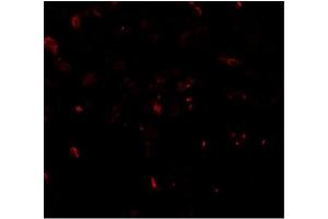 Immunofluorescence of TFEB in human lung tissue with TFEB antibody at 20 μg/mwith TFEB antibody at 2 µg/ml (TFEB 抗体  (N-Term))