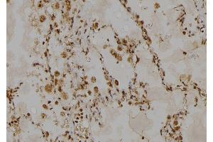ABIN6268885 at 1/100 staining Human lung tissue by IHC-P. (HSPH1 抗体  (C-Term))