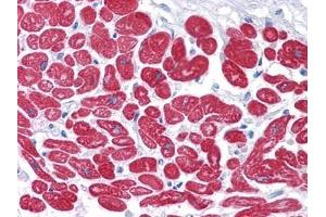 Immunohistochemical analysis of paraffin-embedded human Heart tissues using MYL3 antibody. (MYL3/CMLC1 抗体)