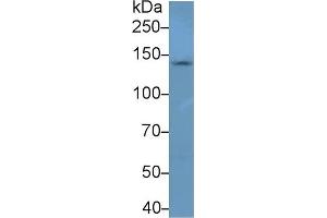 Detection of NEF3 in Mouse Cerebrum lysate using Polyclonal Antibody to Neurofilament 3 (NEF3) (NEFM 抗体  (AA 105-287))