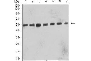 Western Blotting (WB) image for anti-beta-1,3-Glucuronyltransferase 1 (Glucuronosyltransferase P) (B3GAT1) (AA 35-191) antibody (ABIN7193207)