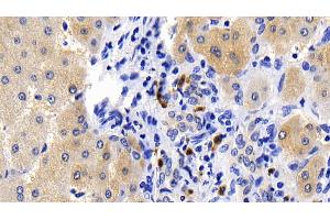 Detection of CASP1 in Human Liver Tissue using Polyclonal Antibody to Caspase 1 (CASP1) (Caspase 1 抗体  (AA 120-297))