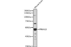 Western blot analysis of extracts of Mouse brain, using PRK antibody (ABIN6129909, ABIN6146189, ABIN6146191 and ABIN6218391) at 1:1000 dilution.