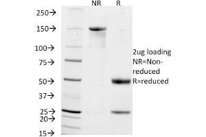 SDS-PAGE (SDS) image for anti-Neural Cell Adhesion Molecule 1 (NCAM1) antibody (ABIN6940173)