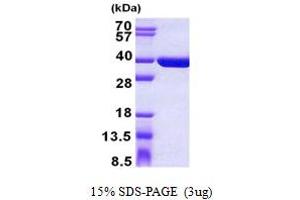 Sulfotransferase Family, Cytosolic, 1C, Member 4 (SULT1C4) (AA 1-302) protein (His tag)