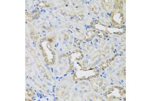 Immunohistochemistry of paraffin-embedded rat kidney using AHCYL1 antibody (ABIN5975313) at dilution of 1/100 (40x lens). (AHCYL1 抗体)