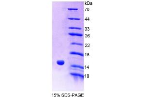 Image no. 1 for Acylphosphatase 2, Muscle Type (Acyp2) (AA 2-99) protein (His tag) (ABIN6239073)