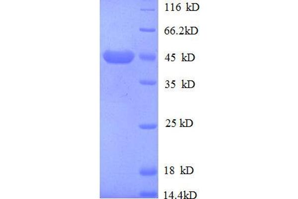IGF2R Protein (AA 2328-2491, partial) (GST tag)
