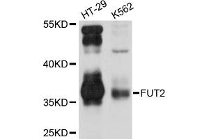 Western blot analysis of extracts of various cell lines, using FUT2 antibody. (FUT2 抗体)