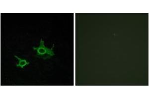 Immunofluorescence analysis of COS7 cells, using FZD3 Antibody. (FZD3 抗体  (AA 141-190))