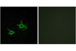 Immunofluorescence analysis of COS7 cells, using FZD3 Antibody. (FZD3 抗体  (AA 141-190))