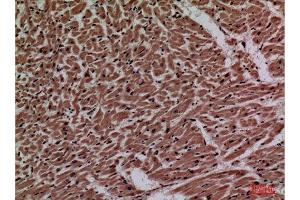 Immunohistochemistry (IHC) image for anti-Purinergic Receptor P2x, Ligand-Gated Ion Channel, 3 (P2RX3) (Internal Region) antibody (ABIN3187746)