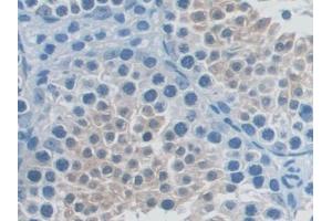 DAB staining on IHC-P; Samples: Mouse Testis Tissue (TNFRSF11A 抗体  (AA 359-542))