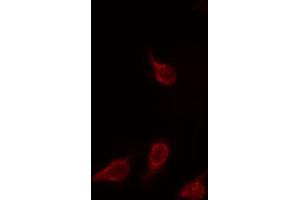 ABIN6266925 staining HuvEc by IF/ICC. (EIF3L 抗体  (N-Term))