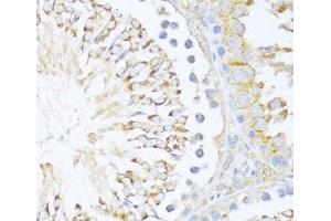 Immunohistochemistry of paraffin-embedded Rat testis using DDX3Y Polyclonal Antibody at dilution of 1:100 (40x lens). (DDX3Y 抗体)