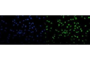 IF analysis of Transketolase/TKT using anti-Transketolase/TKT antibody (ABIN7598957).