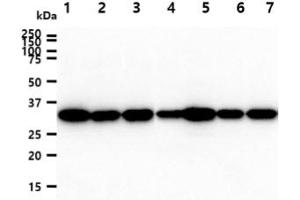 The cell lysates (40ug) were resolved by SDS-PAGE, transferred to PVDF membrane and probed with anti-human PPIE antibody (1:1000). (PPIE 抗体)