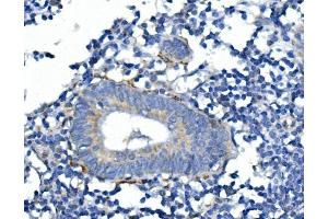 IHC analysis of SYP using anti-SYP antibody (ABIN7603120). (Synaptophysin 抗体  (N-Term))