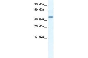 Annexin A7 antibody used at 2. (Annexin VII 抗体  (N-Term))